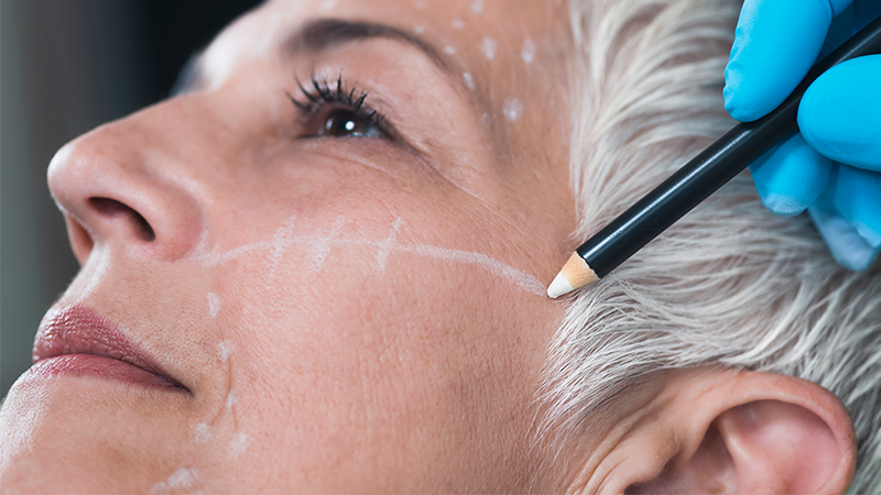 An older woman getting her face marked up with a pencil. Facelift concept.
