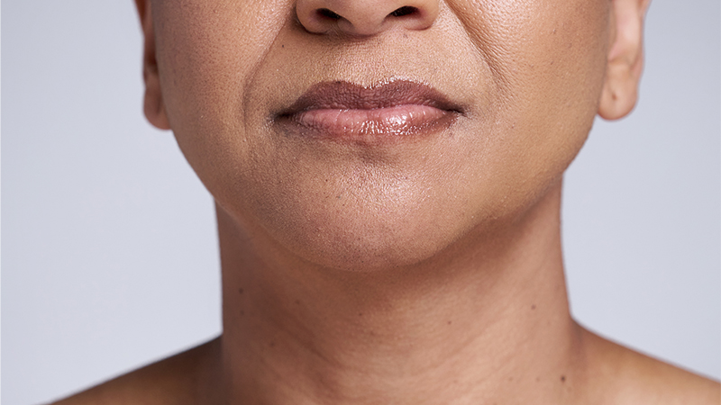 An older woman with a smooth neck after a neck lift procedure.
