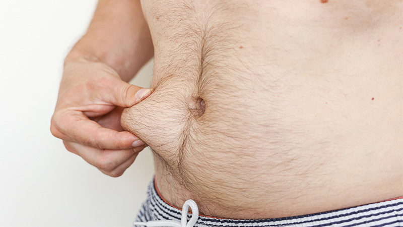 A man pinching his love handles. Liposuction concept.