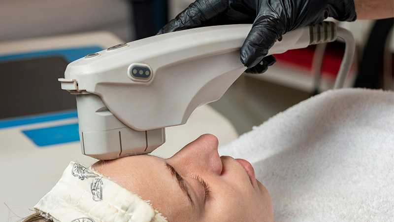 A woman receiving an Ultherapy treatment.